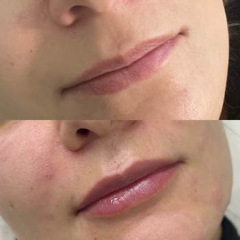 Маргарита Перченко, Дніпро Фото - 11