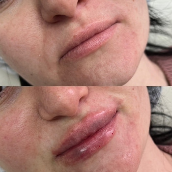 Маргарита Перченко, Дніпро Фото - 20