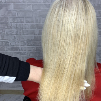 Фото після процедури