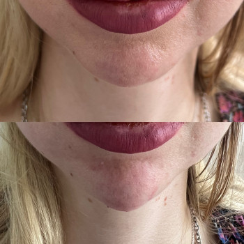 Маргарита Перченко, Дніпро Фото - 24