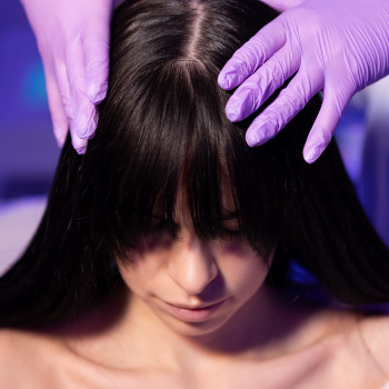 Мезотерапія волосистої частини голови
                    Косметологический центр МаКо Киев