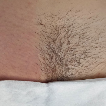 Зона глибокого бікіні . 10 хвилин . 330 грн