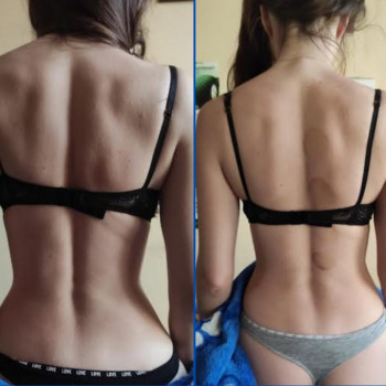 Dr. Hill, Киев Фото - 6