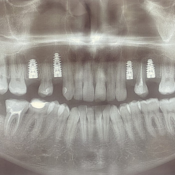 T-dent стоматологія, Чернівці Фото - 5