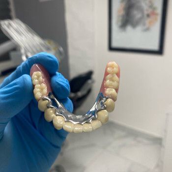 T-dent стоматологія, Чернівці Фото - 7