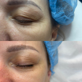 Алена Белозерова, Харьков Фото - 22