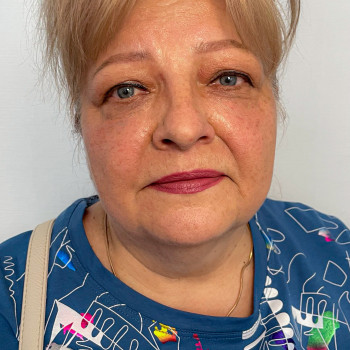 Загоєний перманент брів, 5 місяців