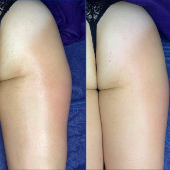 Масаж "Dr. Hill". Авторська методика
                    Массажный салон Dr. Hill Киев