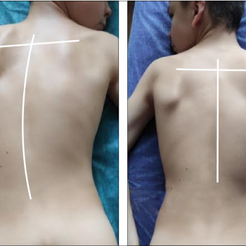 Масаж "Dr. Hill". Авторська методика
                    Массажный салон Dr. Hill Киев