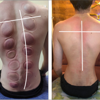 Масаж "Dr. Hill". Авторська методика
                    Массажный салон Dr. Hill Киев