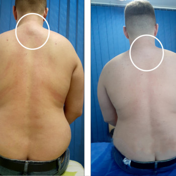 Масаж "Dr. Hill". Авторська методика
                    Массажный салон Dr. Hill Киев