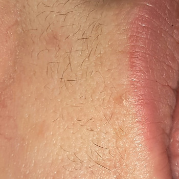 Електро Епіляція
                    Електролог Наталя Хмельницький