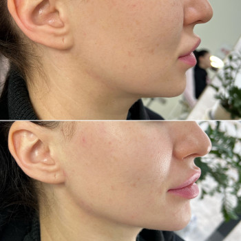 Аліна Яковлєва, Дніпро Фото - 21