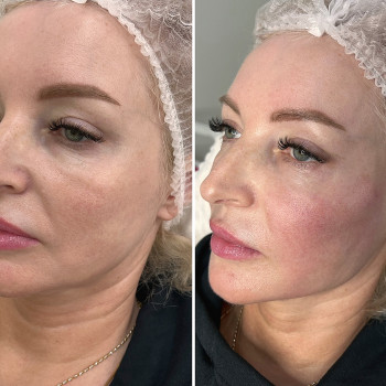 Аліна Яковлєва, Дніпро Фото - 3