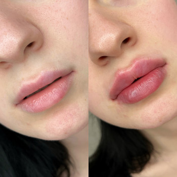 Аліна Яковлєва, Дніпро Фото - 7