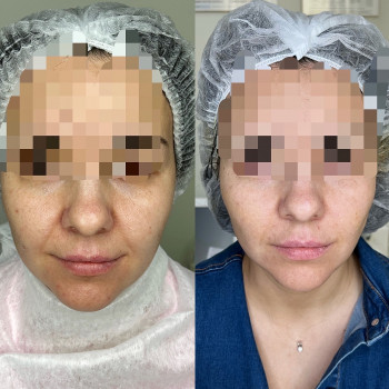 Аліна Яковлєва, Дніпро Фото - 10