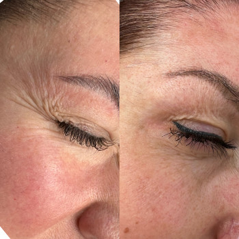 Аліна Яковлєва, Дніпро Фото - 22