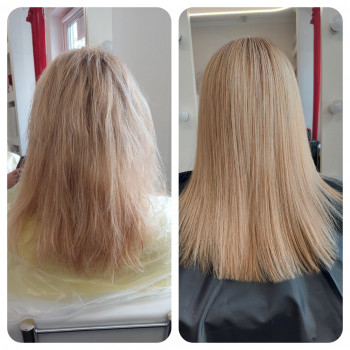 Вирівнювання біксіпластія