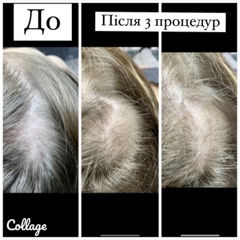 Христина Чорній, Тернополь Фото - 64