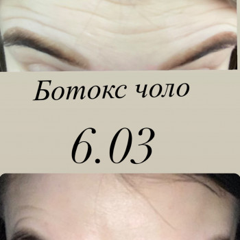 Христина Чорній, Тернополь Фото - 65