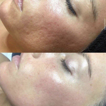 Оксана Гостищева, Запоріжжя Фото - 7