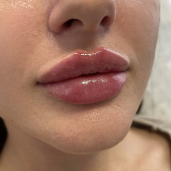 Оксана Гостищева, Кропивницький Фото - 19