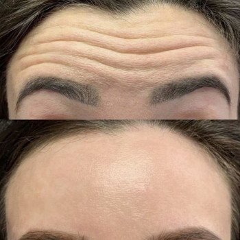 Оксана Гостищева, Кропивницький Фото - 20