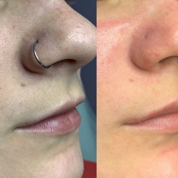 MBar, Вишневе Фото - 12