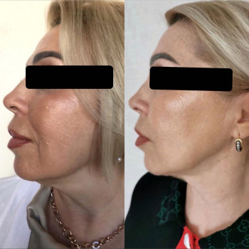 Ageless Esthetic Center, Трускавець Фото - 13