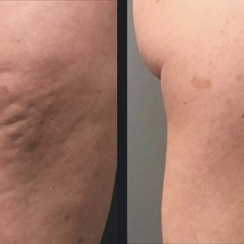 Ageless Esthetic Center, Трускавець Фото - 14