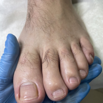 Подологічний педикюр
                    Подолог Наталія Київ