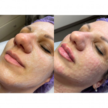 Катерина Романчук, Київ Фото - 33