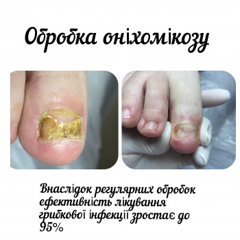 Юлія Бугайова, Чернігів Фото - 8