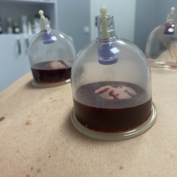 Анна Білик, Хмельницький Фото - 7