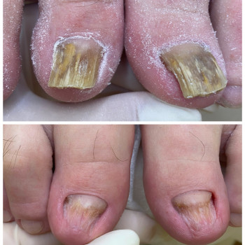 Алена Колева, Одеса Фото - 5