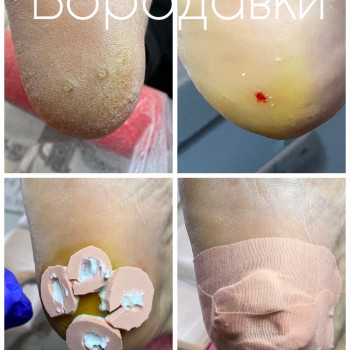 Алена Колева, Одеса Фото - 7