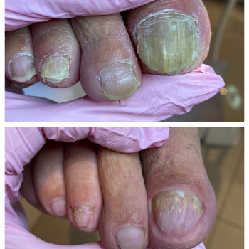 Алена Колева, Одеса Фото - 13