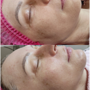 Наталія Шаталова, Одесса Фото - 8