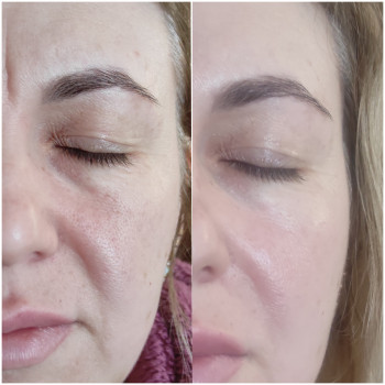 Наталія Шаталова, Одесса Фото - 10