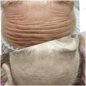 корекція вікових змін