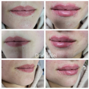 Вікторія Гаврілей, Васильков Фото - 5