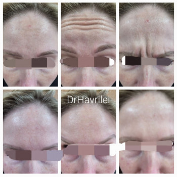 Вікторія Гаврілей, Васильков Фото - 6