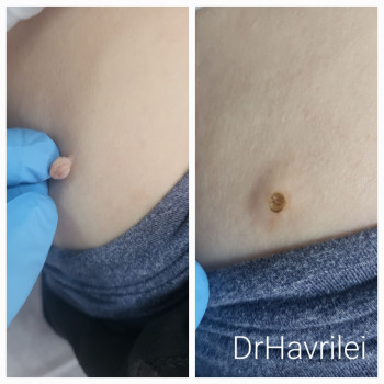 Вікторія Гаврілей, Васильков Фото - 8