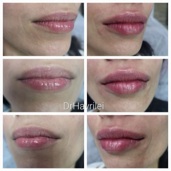 Вікторія Гаврілей, Васильков Фото - 9