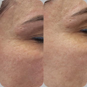 Анастасия Прийтенко, Днепр Фото - 7