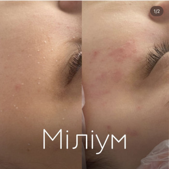 Марія Косметолог, Кривий Ріг Фото - 10