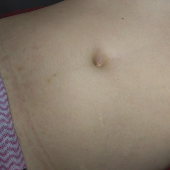 Валерія Садовнича, Сумы Фото - 3