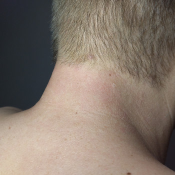 Валерія Садовнича, Сумы Фото - 5