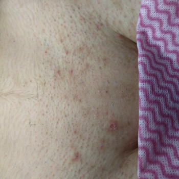 Валерія Садовнича, Сумы Фото - 15