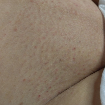 Валерія Садовнича, Сумы Фото - 16